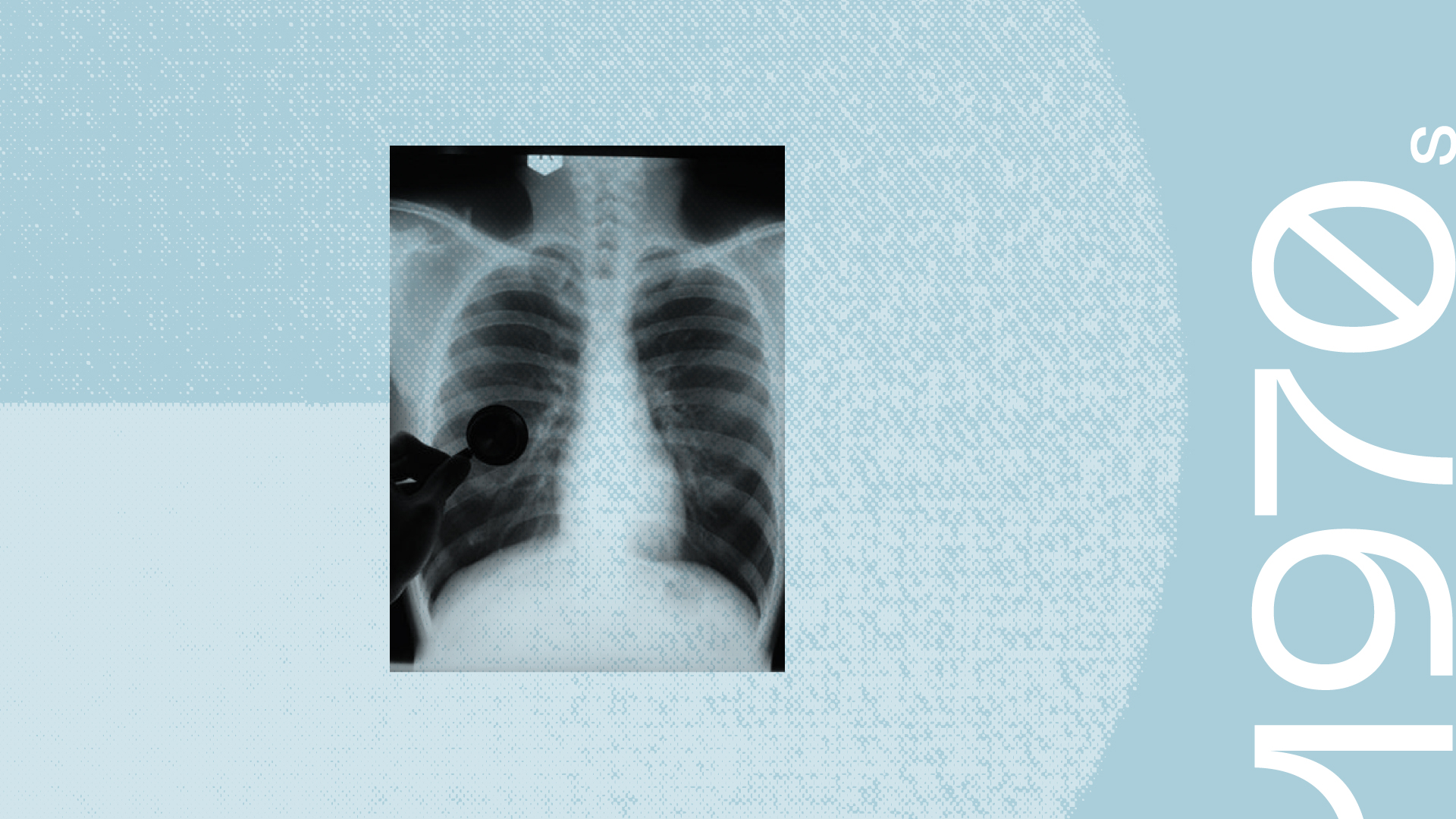 Environmental causes of lung disease