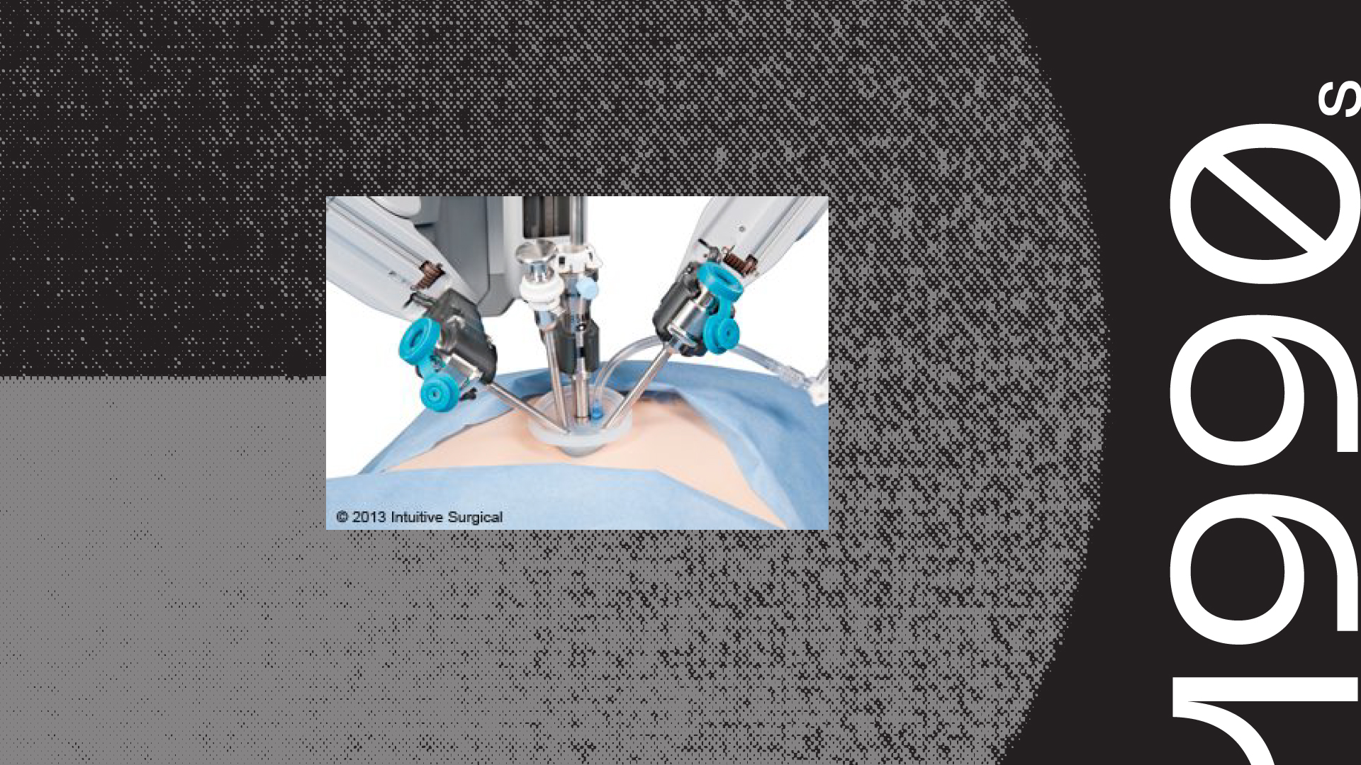 Telerobotic surgery